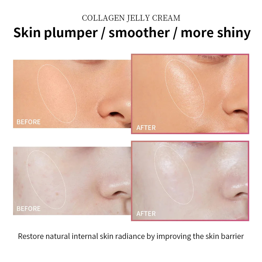 Lakerain Anti Aging Collagen Face Cream Niacinamide Hydrating Gel