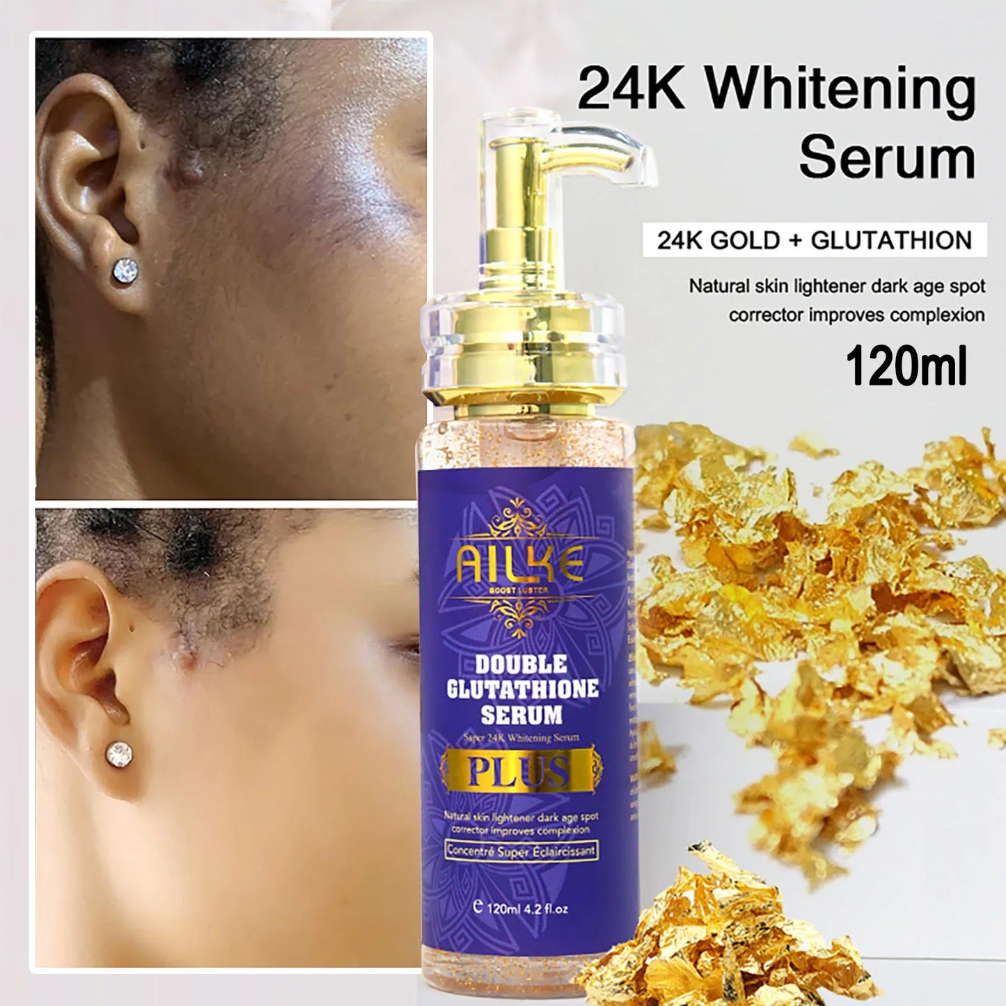 AILKE Brightening Body Milk For Uneven Tone And Dark Spots