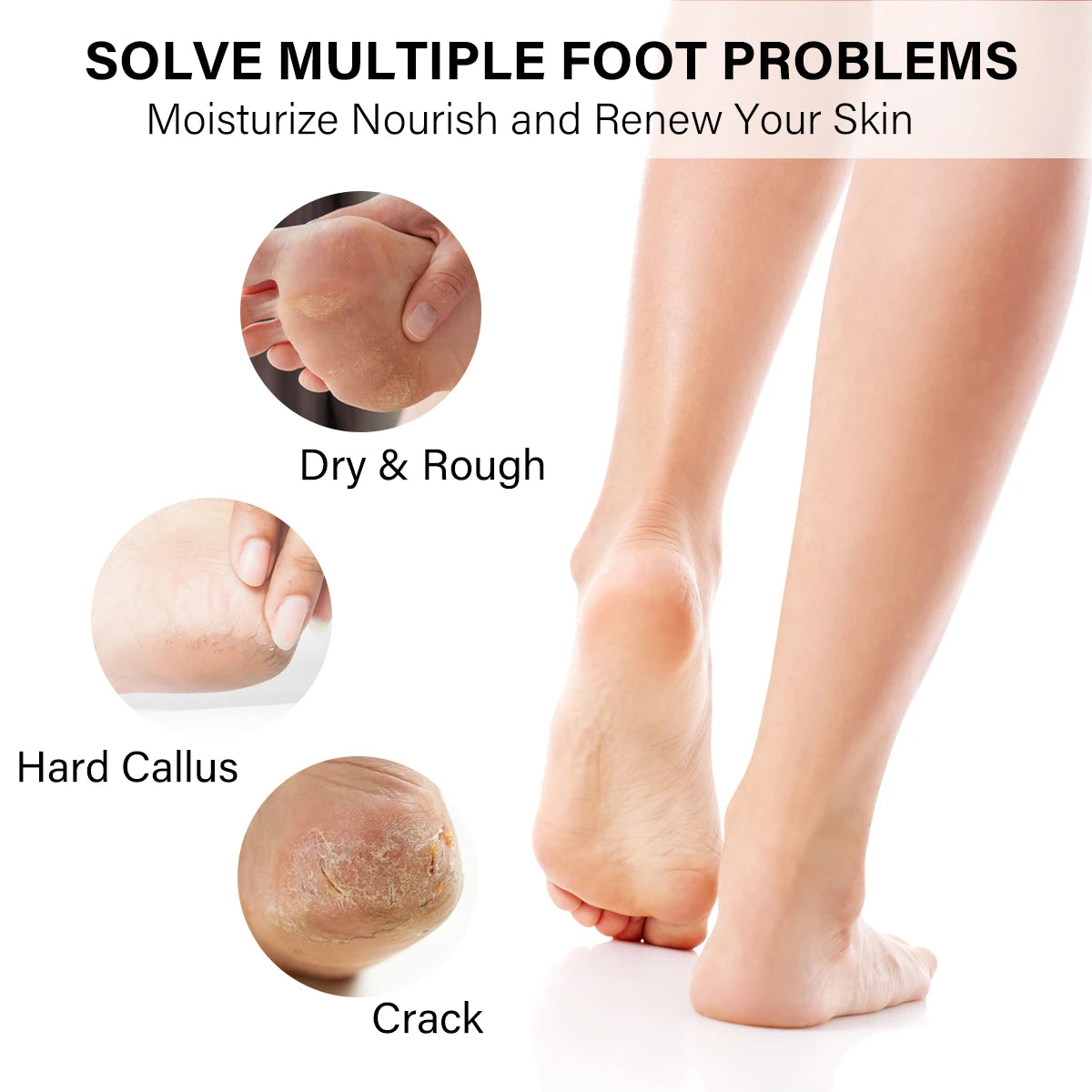 FootNICE 4 Step Spa Pedicure Kit 4-In-1 Deluxe Foot Care