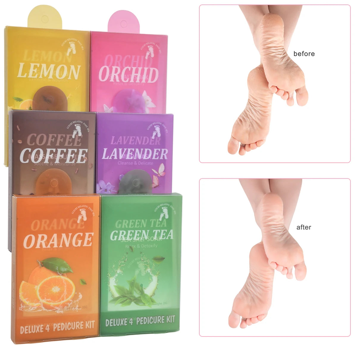 FootNICE 4 Step Spa Pedicure Kit 4-In-1 Deluxe Foot Care