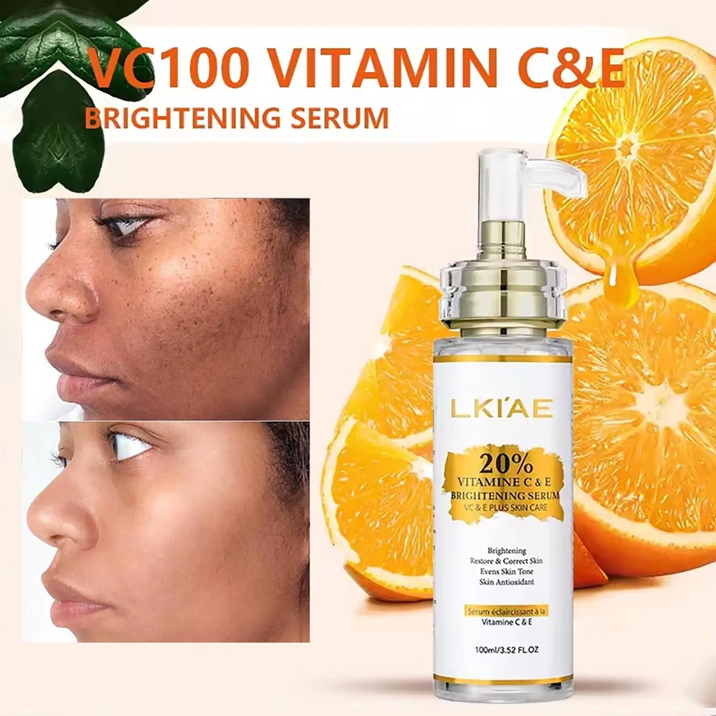 AILKE Vitamin C And E Brightening Serum For Dark Spots